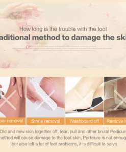 Scrub Exfoliating,Massager,Foot Scrub,Exfoliating Massager,Foot Scrub Exfoliating