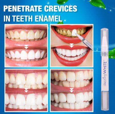 Instant Brightify Oral Pen,Brightify Oral Pen,Oral Pen,Instant Brightify