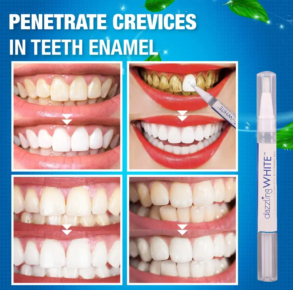 Instant Brightify Oral Pen,Brightify Oral Pen,Oral Pen,Instant Brightify