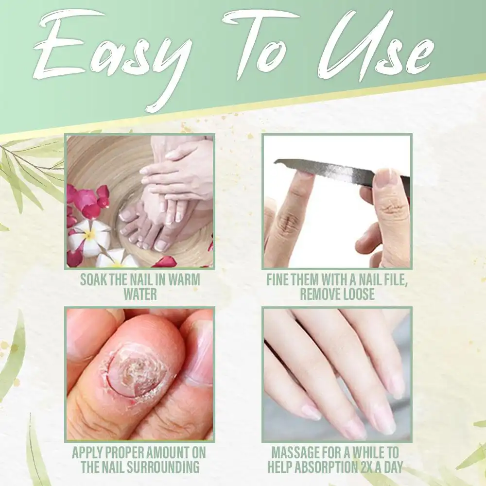 Nail Fungus Instant Treatment Gel,Nail Fungus,Instant Treatment,Treatment Gel,gel