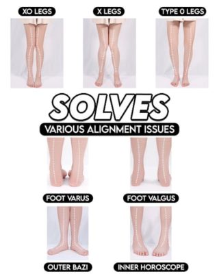 Orthopedic Insoles,Flat Foot Orthopedic,Foot Orthopedic,Flat Foot