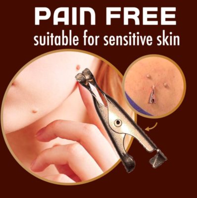 Tag Away Copper Clip Set,Copper Clip Set,Clip Set,Tag Away Copper