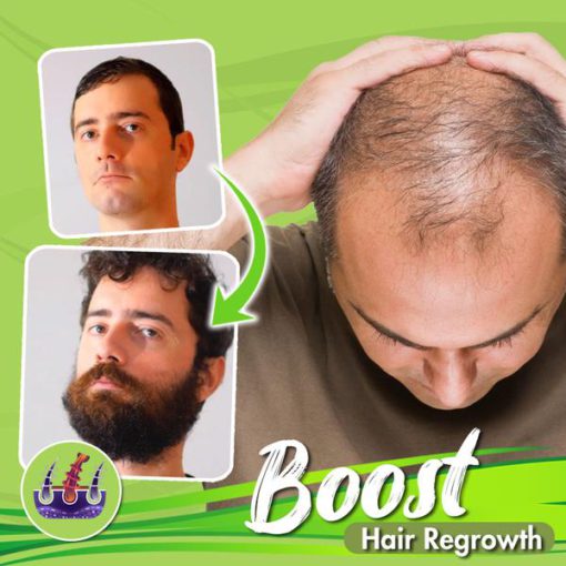 Zázvorový olej na rast celého tela, zázvorový olej na rast vlasov, zázvorový olej, zázvorový olej, rast vlasov na celom tele