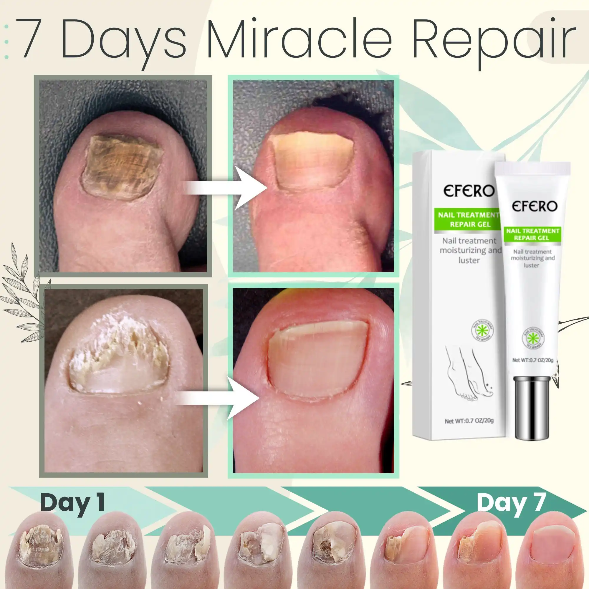 Toe Be Health 7 Days Treatment Gel,Toe Be Health,Treatment Gel,7 Days Treatment Gel