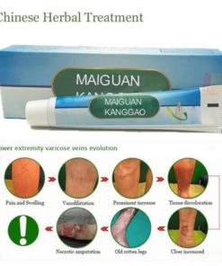 Varicose Veins Treatment Cream,Veins Treatment Cream,Treatment Cream,Varicose Veins Treatment,Varicose Veins