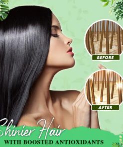 Anti-Dandruff Treatment Essence,Treatment Essence,Anti-Dandruff