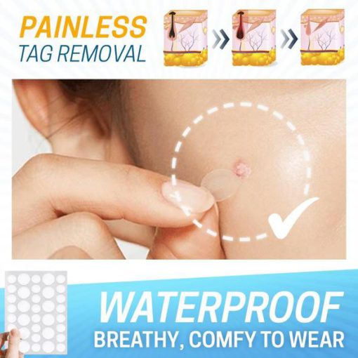 Skin Tag Pain-Free Remover Patch, Remover Patch, Skin Tag, Pijnvrij