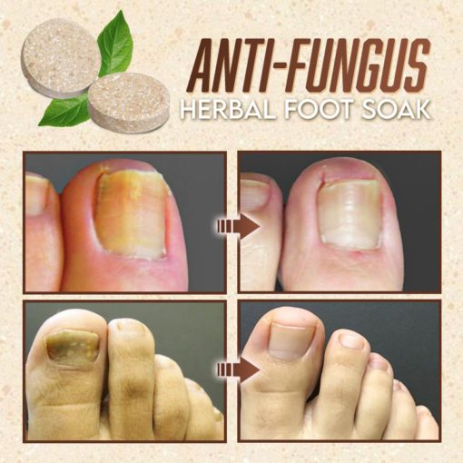 Herbal Foot Soak,Foot Soak,Herbal Foot,Anti-Fungal,Anti-Fungal Herbal Foot Soak