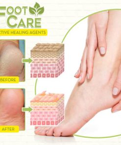 Fungal Reverse Herbal Treatment Foot Soak,Reverse Herbal Treatment Foot Soak,Herbal Treatment Foot Soak,Treatment Foot Soak,Foot Soak