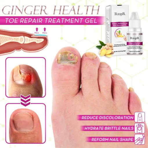 Ginger Health Toel Repair Treatment Gel, Health Toe Repair Treatment Gel, Toe Repair Treatment Gel, Repair Treatment Gel, Treatment Gel