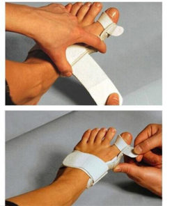 Bunion Corrector,Corrector