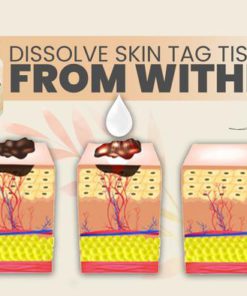 SpotOut Organic Purifying Serum,Organic Purifying Serum,Purifying Serum,Organic Purifying,SpotOut Organic