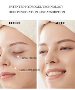 Lifting Decree Patch,Decree Patch,Hyaluronic Acid,Microcrystalline Lifting