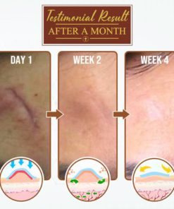 Body Mark Repair Treatment Gel,Repair Treatment Gel,Treatment Gel,Body Mark