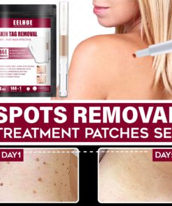 Spots Removal Treatment Patches Set,Spots Removal Treatment Patches,Spots Removal,Treatment Patches Set,Treatment Patches