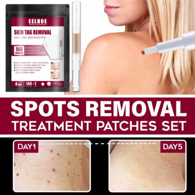 Spots Removal Treatment Patches Set,Spots Removal Treatment Patches,Spots Removal,Treatment Patches Set,Treatment Patches