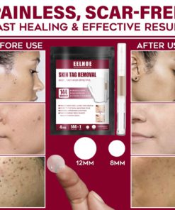 Spots Removal Treatment Patches Set,Spots Removal Treatment Patches,Spots Removal,Treatment Patches Set,Treatment Patches