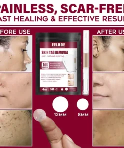 Spots Removal Treatment Patches Set,Spots Removal Treatment Patches,Spots Removal,Treatment Patches Set,Treatment Patches