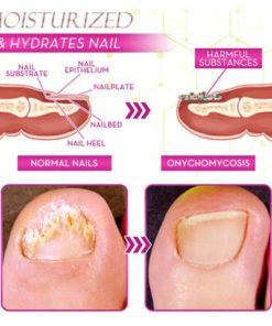 Ginger Health Toe Repair Treatment Gel,Health Toe Repair Treatment Gel,Toe Repair Treatment Gel,Repair Treatment Gel,Treatment Gel