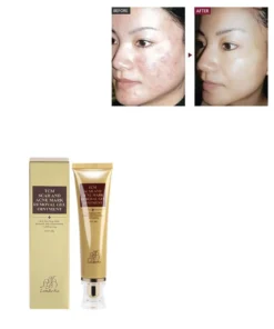 Scar Remover Cream,Acne Scar Remover,Acne Scar,Remover Cream