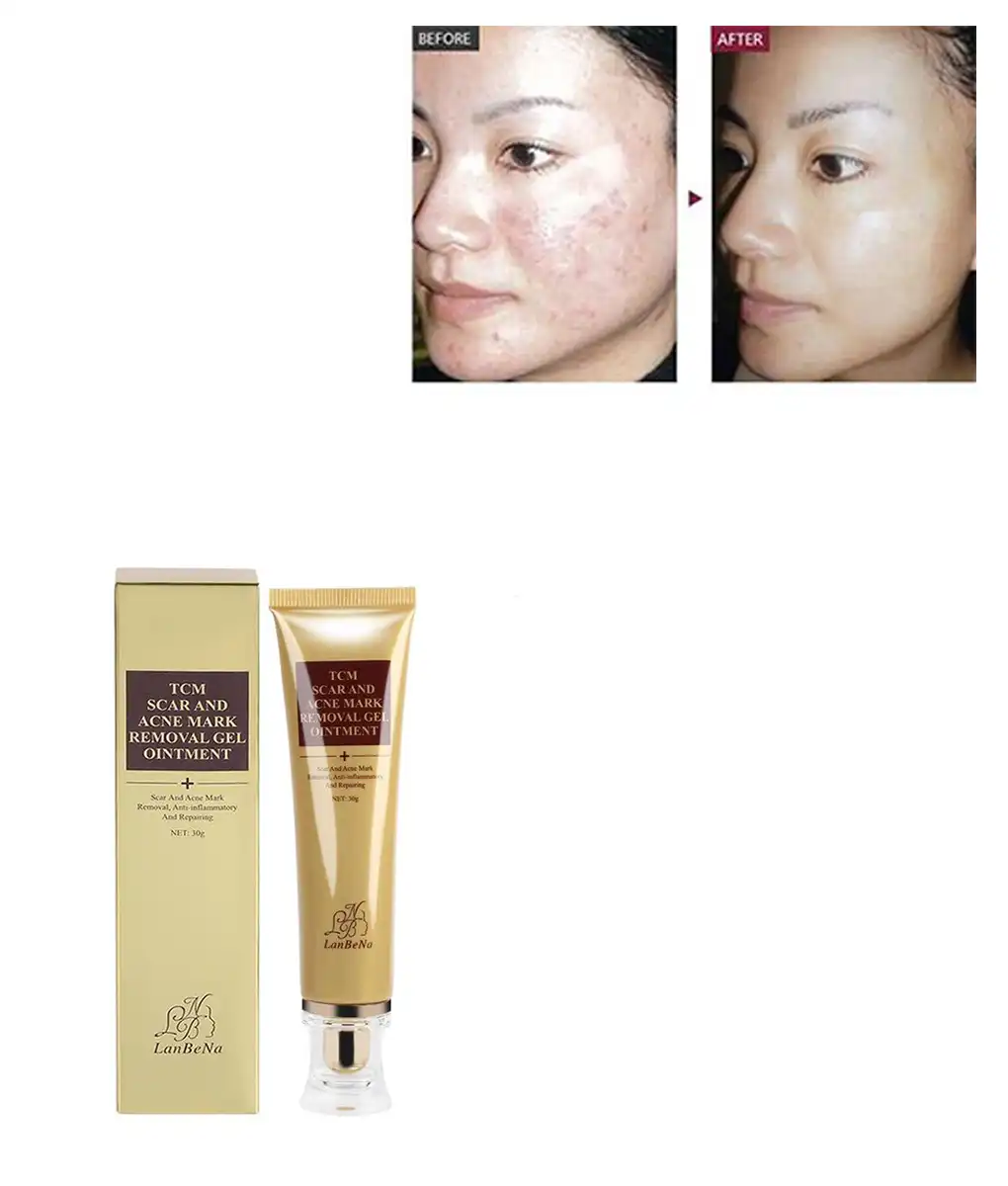 Scar Remover Cream,Acne Scar Remover,Acne Scar,Remover Cream