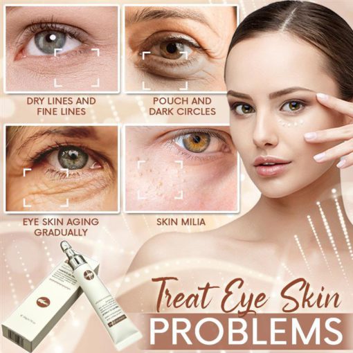 Anti FatGranule Eye Cream,Anti FatGranule,Crema per gli occhi
