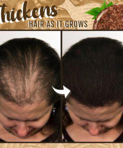 Caffeine Hair Rejuvenation Shampoo Bar,Hair Rejuvenation Shampoo Bar,Rejuvenation Shampoo Bar,Shampoo Bar