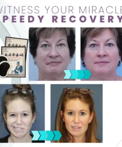 Facial Immobility Herbal Relief Patch,Facial Immobility,Herbal Relief Patch,Relief Patch,Herbal Relief