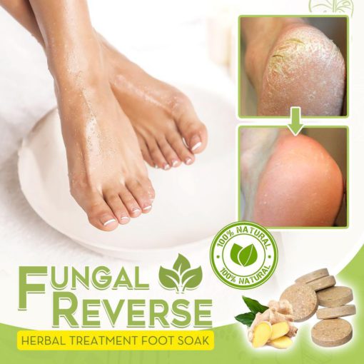 Fungal Reverse Herbal Treatment Foot Soak,Reverse Herbal Treatment Foot Soak,Herbal Treatment Foot Soak,Treatment Foot Soak,Foot Soak