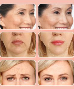 Time Eraser Botox Concentrate Ampoule,Time Eraser Botox,Concentrate Ampoule,Botox Concentrate Ampoule,Time Eraser