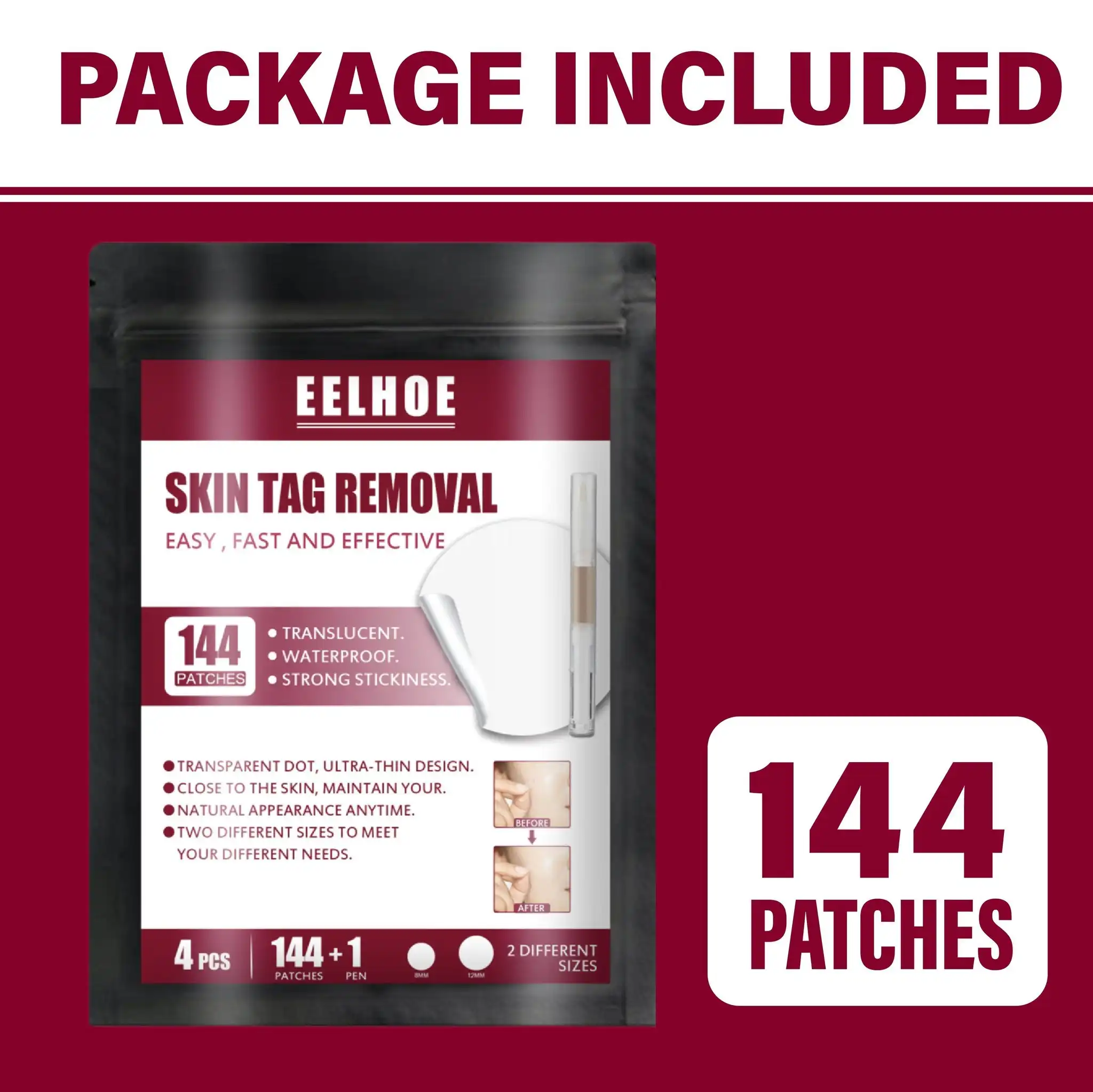 Spots Removal Treatment Patches Set,Spots Removal Treatment Patches,Spots Removal,Treatment Patches Set,Treatment Patches