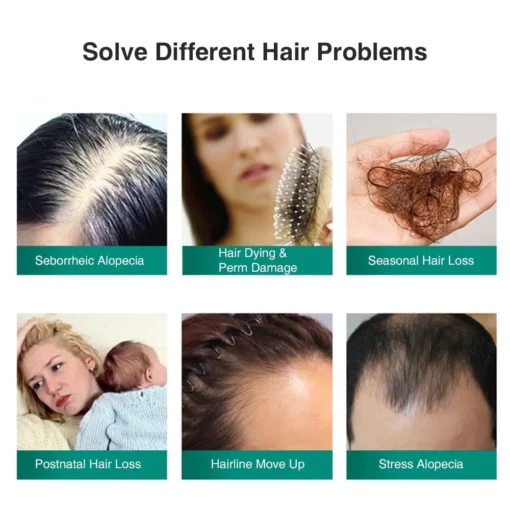 Spray za rast las, sprej za rast, rast las, ingverjeva rast las, ingverjev sprej za rast las