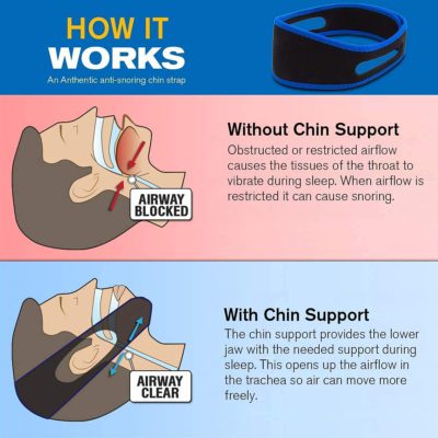 Anti Snoring Solution,Anti Snoring,Snoring Solution