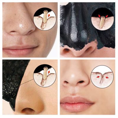 Blackhead Remover,Blackhead Remover Mask