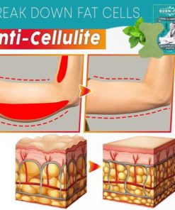 Arm Slimming,Moxibustion Patch,Burn-FAT,Burn-FAT Arm Slimming Moxibustion Patch