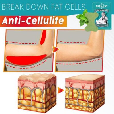 Arm Slimming,Moxibustion Patch,Burn-FAT,Burn-FAT Arm Slimming Moxibustion Patch