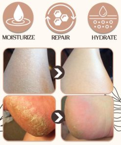 Cracked and Dry Heel Repair Clam Balm