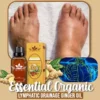 Essential Oil For Bruises and Swelling,Oil For Bruises and Swelling,Essential Oil For Bruises