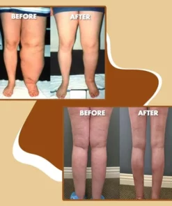 Essential Organic Lymphatic Tumeric Oil,Organic Lymphatic Tumeric Oil,Lymphatic Tumeric Oil,Tumeric Oil,Essential Organic Lymphatic