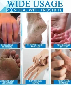 FrostbiteFree Skin Restoration Ointment,Skin Restoration Ointment,Skin Restoration,Restoration Ointment