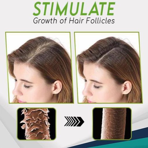 Hair-Growth Essence Spray,HerbalRevive Hair-Growth Essence Spray