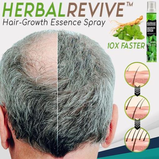 Spray per l'essenza della crescita dei capelli,HerbalRevive Spray per l'essenza della crescita dei capelli