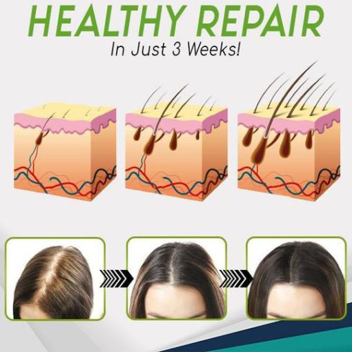 Esence ve spreji pro růst vlasů, HerbalRevive Essence Spray pro růst vlasů