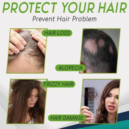 Hair-Growth Essence Spray, HerbalRevive Hair-Growth Essence Spray