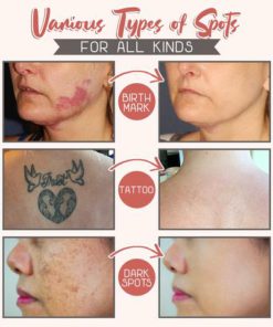 Melanin Removal Skin Balance Serum,Removal Skin Balance Serum,Skin Balance Serum,Balance Serum,Melanin Removal Skin