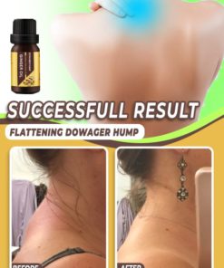 Rolling Tape,Girth Measuring,Measuring Ruler