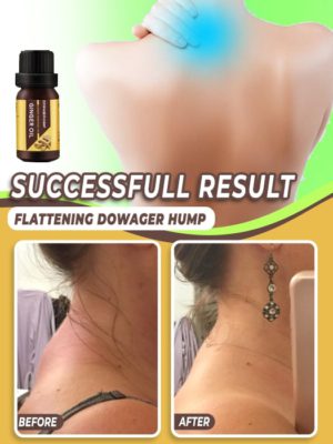 Rolling Tape,Girth Measuring,Measuring Ruler