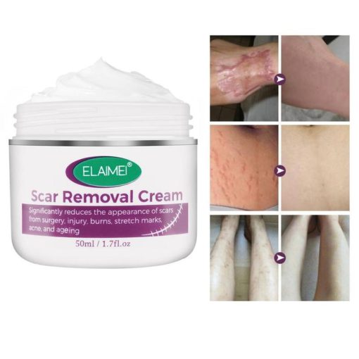 Pag-alis sa Krus, Pagtangtang sa scar, Intensive Scar Removal Cream, Intensive Scar Removal