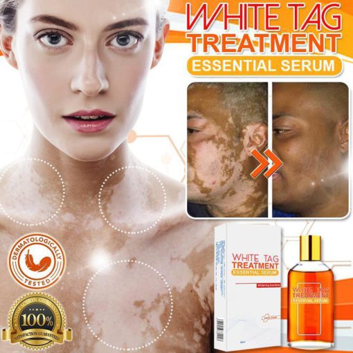 Serum, White Tag, White Tag Treatment Essentiale Serum