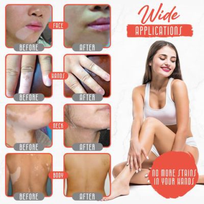 White Tag,Body Spray,White Tag Treatment Moisturizes Body Spray